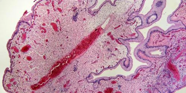 celule placentare