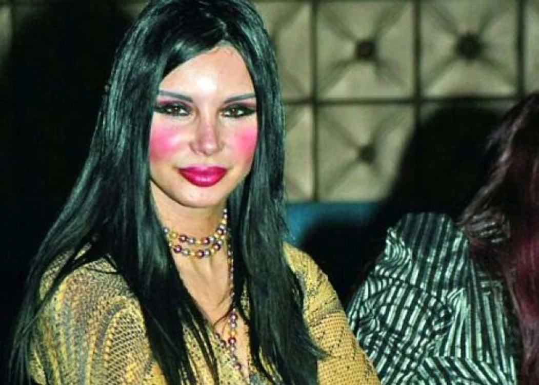Bruneta a exagerat cu acidul hialuronic la buze şi pomeţi Foto: Captură Kanal D