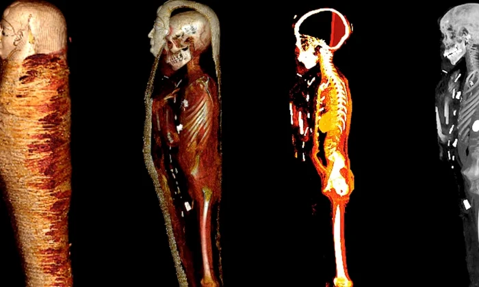 Secretele mumiei „Băiatului de Aur”, dezvăluite de radiografii (oto: Ministry of Tourism and Antiquities وزارة السياحة والآثار )