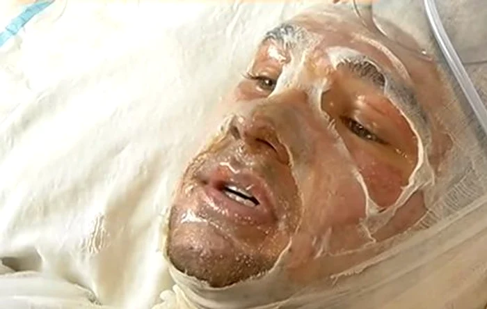 
    Alex (17 ani) a reușit să scape cu viață din incendiul produs în clubul Colectivfoto: captură video Antena 1  