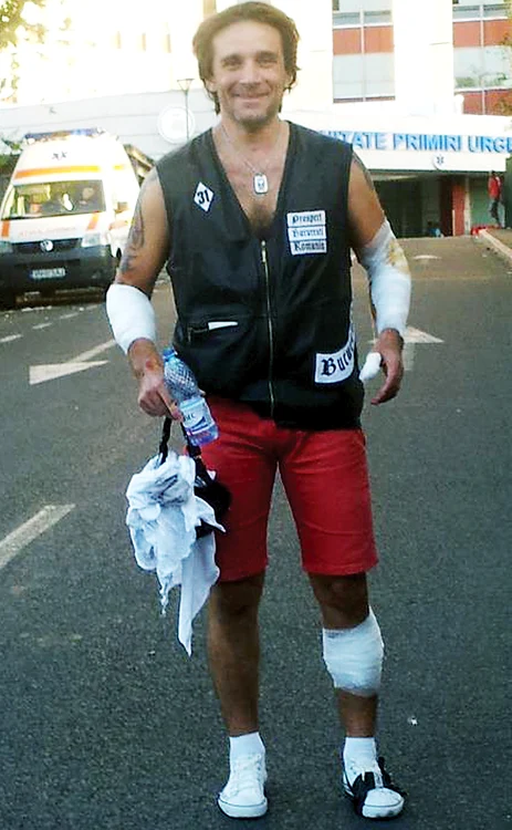 Actorul a făcut marţi accident de motor (Fotografii: Arhivă personală)