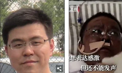 hu weifeng medic chinez jpeg