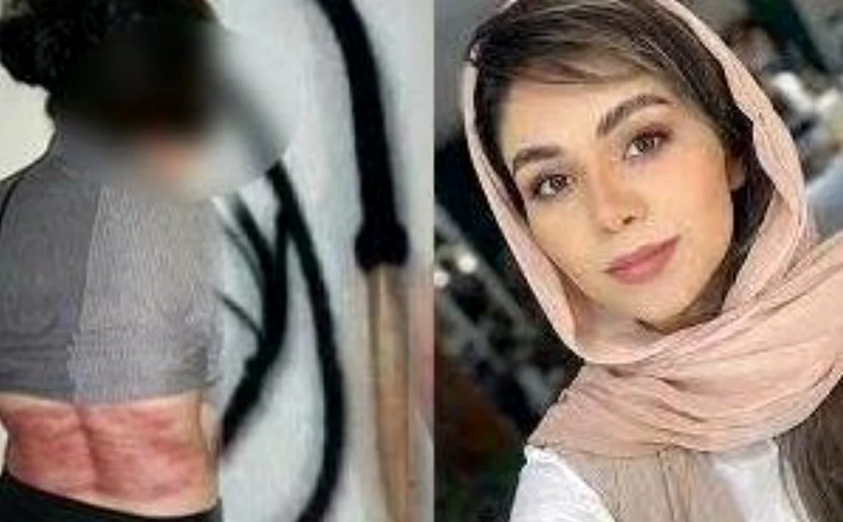 Roya Heshmati a fost biciuită de 74 de ori FOTO The Telegraph