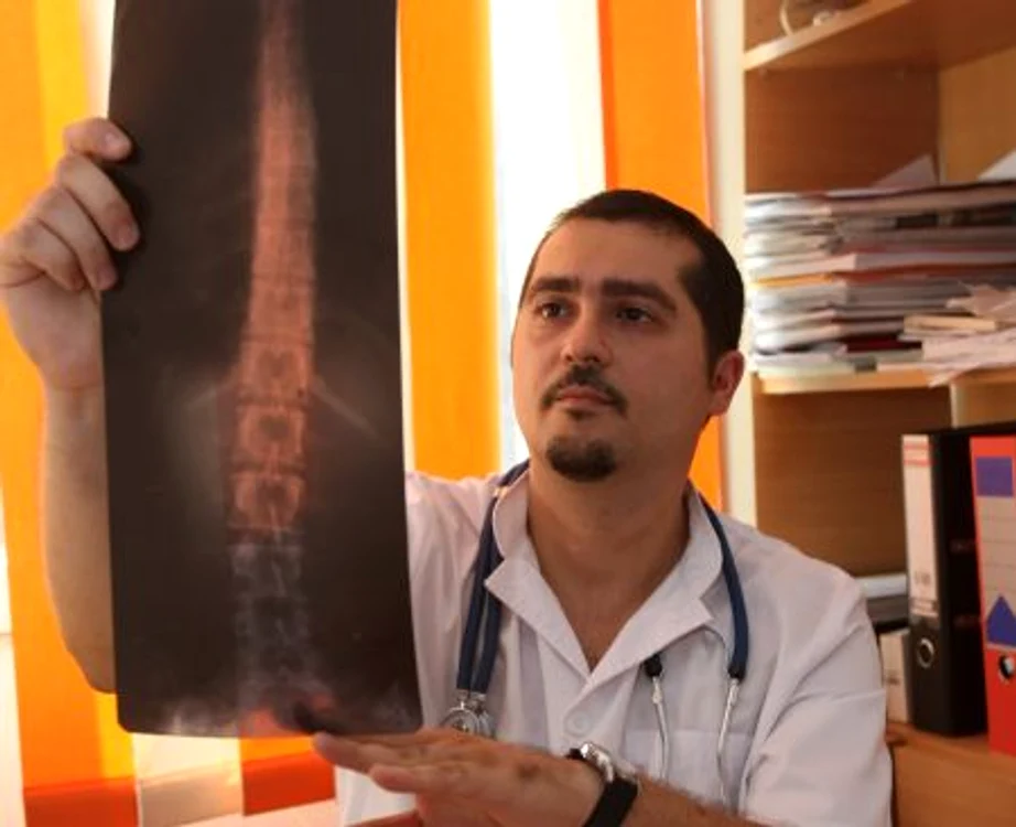 Atat defectele coloanei, cat si herniile se pot vedea pe radiografie