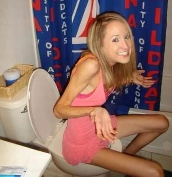 Anorexicele sunt sexy?