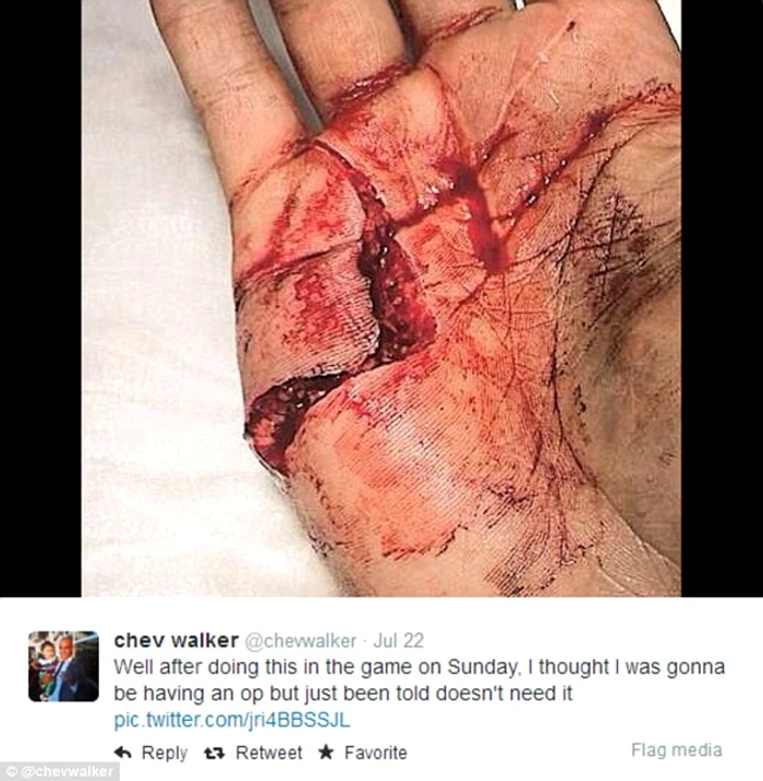 
    Chev Walker a postat pe Twitter imaginea terifiantă  