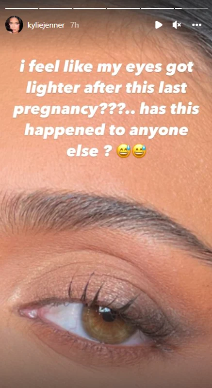 kylie jenner simptom postpartum PNG