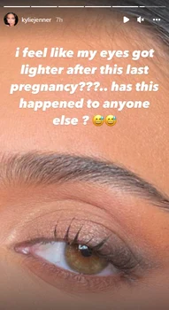 kylie jenner simptom postpartum PNG