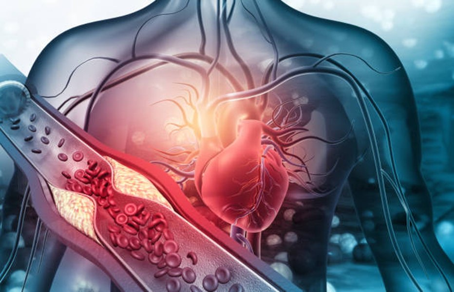 Colesterolul redus într-o săptămână. Cinci pași recomandați de nutriționiști