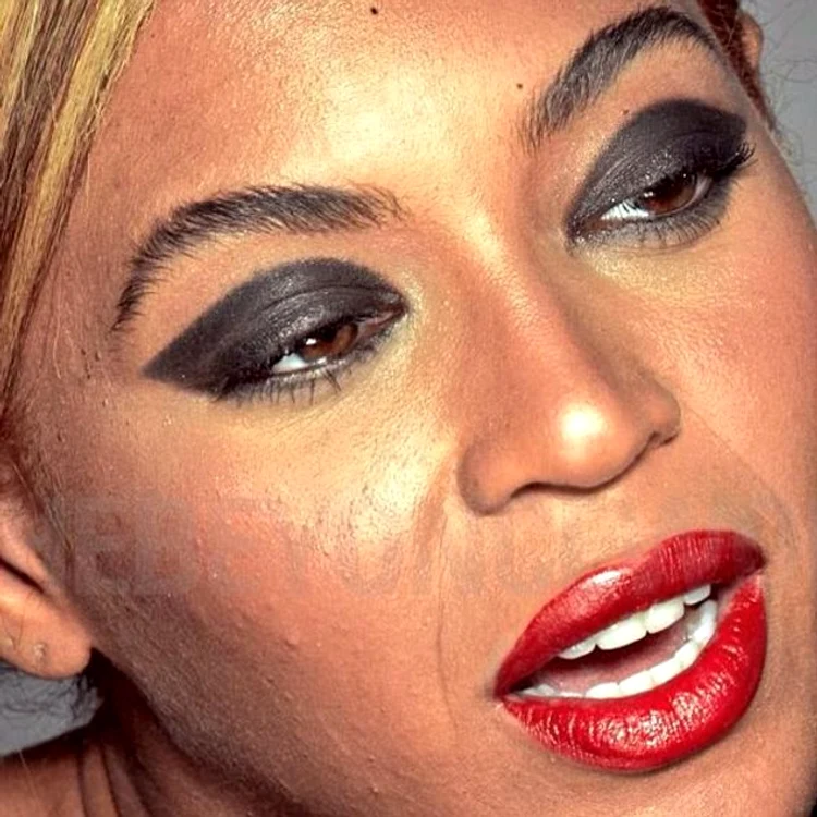 Pielea lui Beyonce nu e netedă, iar cântăreaţa are multe coşuri