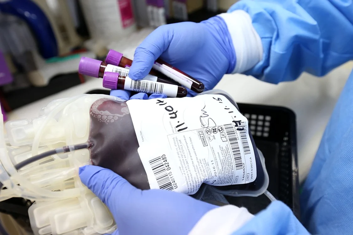 Punga unei plasme de sânge ținută în mâini de doctor