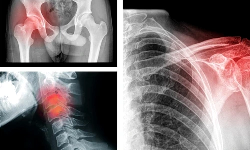 1 9 tipuri de dureri care apar din cauza starilor emotionale nu te ai fi gandit niciodata la asta yfqh jpg jpeg