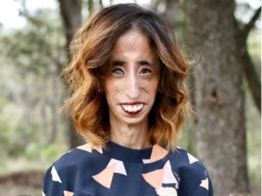 11 lizzie velasquez drama jpg jpeg
