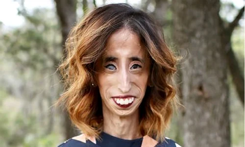 11 lizzie velasquez drama jpg jpeg