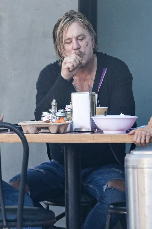 
    Starul a fost surprins, recent, plin de cicatrice, împreună cu un prieten, la un local  