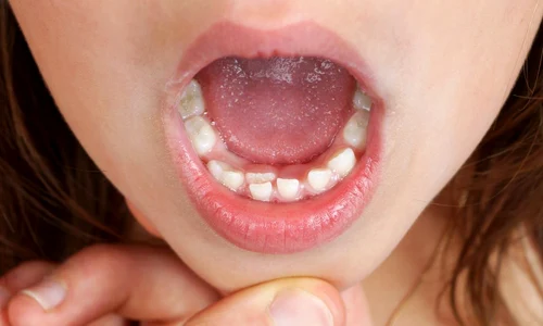 1 shutterstock 210123064 jpg jpeg