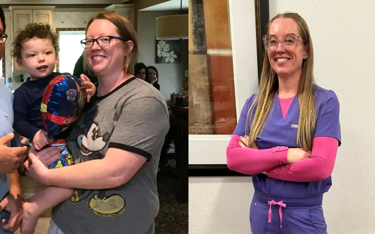 Dr. Betsy Grunch înainte și după FOTO Business Insider