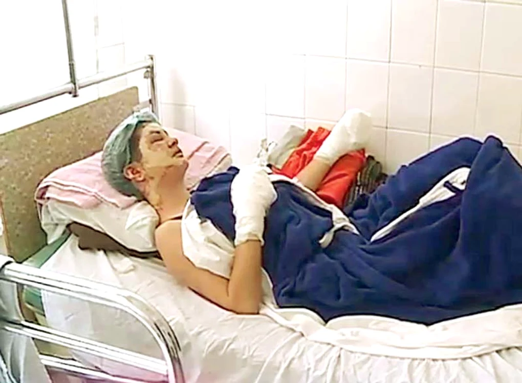 Carmen are arsuri de gradele II şi III şi este internată la Spitalul Clinic Judeţean de Urgenţă Constanţa (CAPTURI: www.rtv.net)