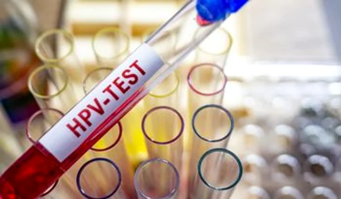 Infecția cu Virusul Papiloma Uman (HPV) este cea mai cunoscută infecție virală cu transmitere prin contact sexual, indiferent dacă acesta este protejat sau nufoto: shutterstock