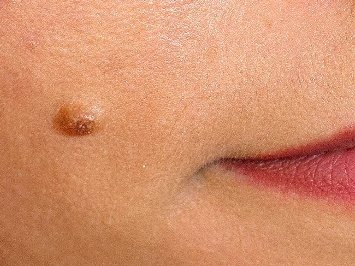 1 cum recunoastem alunitele periculoase jpg jpeg