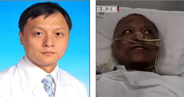 Medic chinez care s-a trezit din coma cu pielea neagra Captura Daily Mail