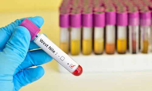 1 shutterstock 337527137 jpg jpeg