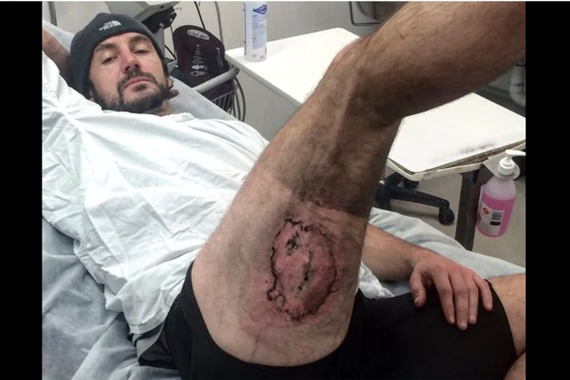 
    Telefonul mobil al australianului a luat foc în buzunarul de la pantalonifoto: arhivă personală  