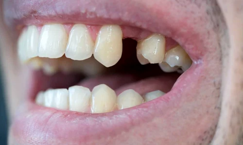 clicksanatate(1) jpg