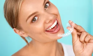 aparat dentar jpeg