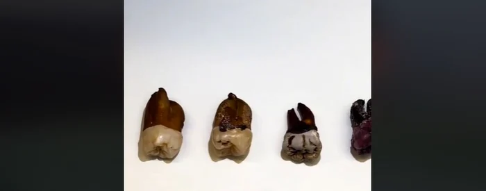 Experimentul unui dentist Foto: Captură video TikTok