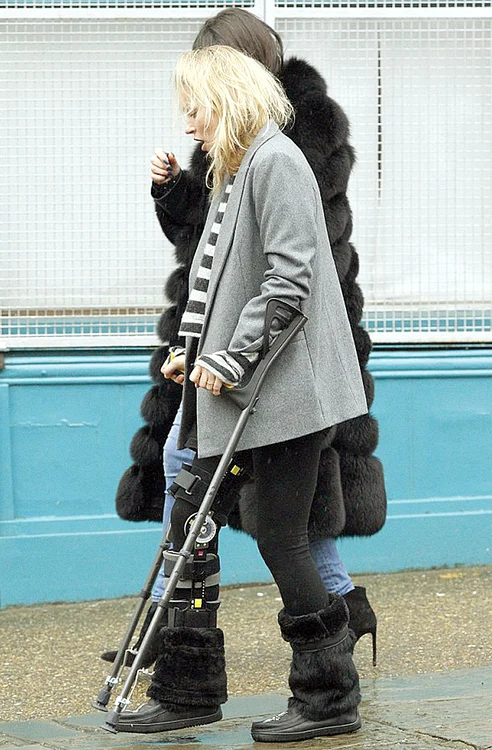 I s-a pus o  orteză la  piciorul  drept şi  merge  în cârje