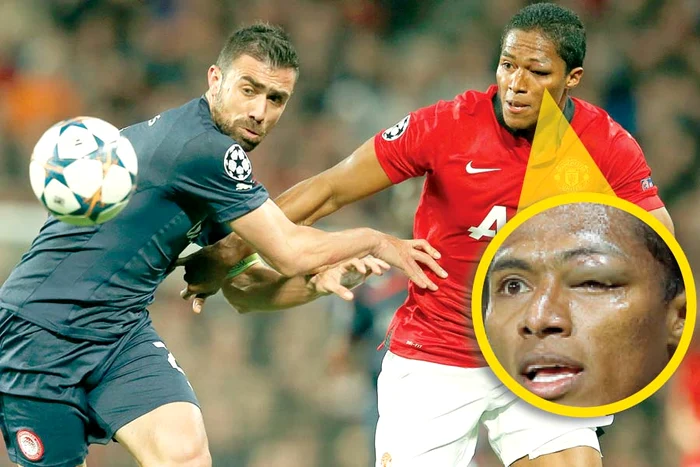 Ecuadorianul Valencia a jucat aproape tot meciul cu un ochi umflat (Fotografii: Reuters)