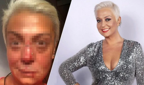 1 monica anghel desfigurata accident 2 840x500 jpg jpeg