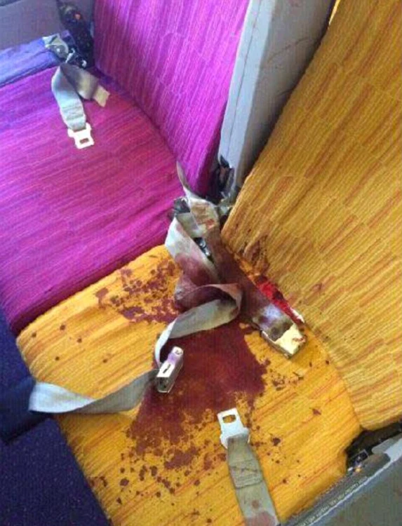 Un pasager a fost lovit la cap din cauza turbulențelor