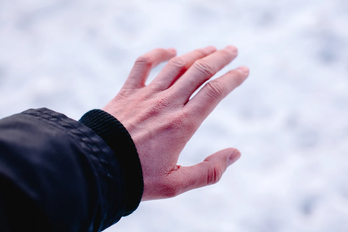 Degeraturile ușoare pot fi tratate acasă. Foto Shutterstock