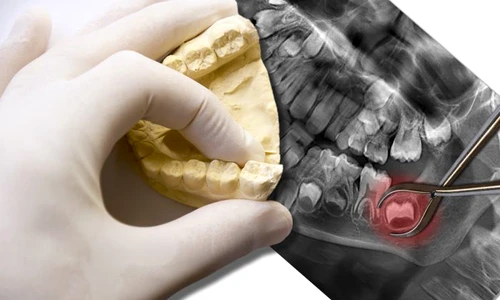 1 shutterstock 385803064 jpg jpeg