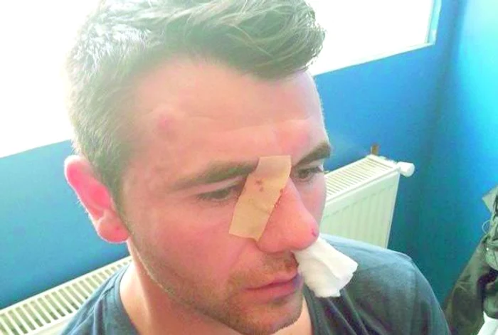 Arbitru băgat în spital de huligani