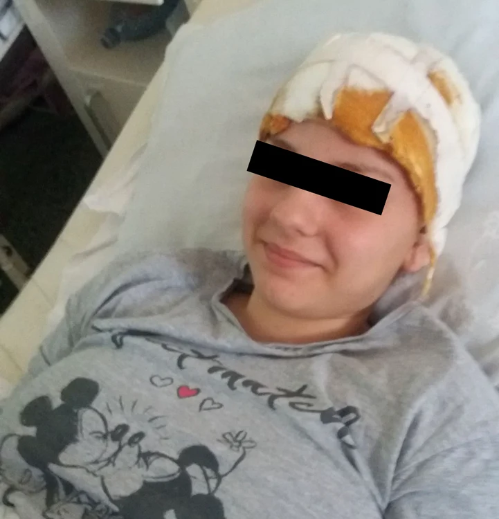
    Tânăra din autobuz a fost operată la capFoto: arhivă personală  