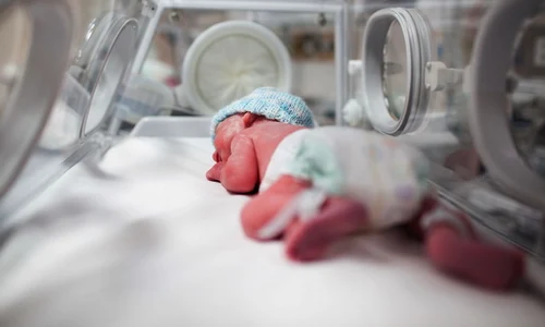 bebelus prematur jpeg