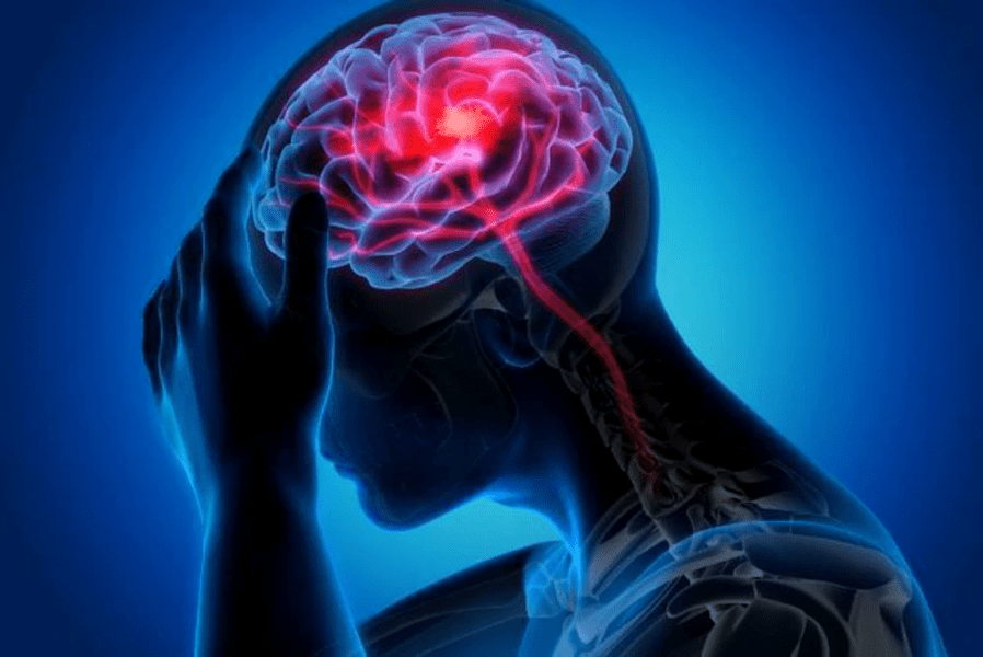 Situație disperată la Neurologie. Medicii nu mai au medicamentele care-i salvează pe pacienți de sechelele unui AVC. „Mai este o fiolă”