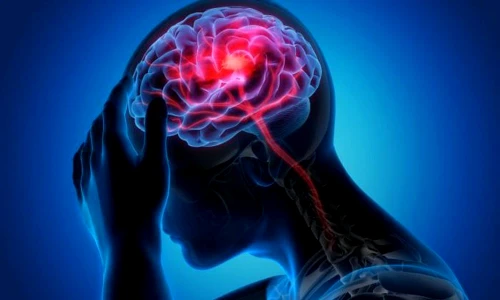 accident vascular jpg