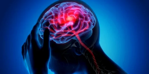 accident vascular jpg