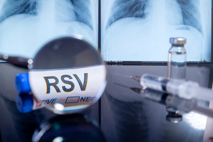 Virusul sincițial respirator (RSV) poate fi mortal pentru bebeluși și vârstnici FOTO SHUTTERSTOCK