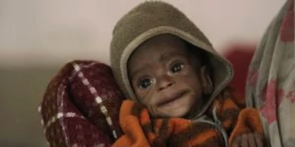 Subnutriția este foarte răspândită în India (Foto: Reuters)