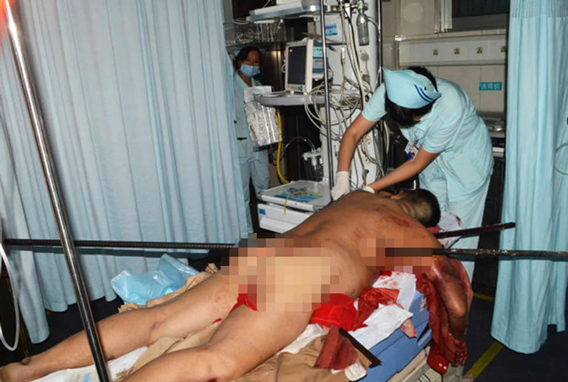 Bărbatul a fost transportat la spital cu bara de fier în el