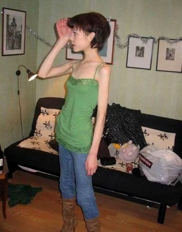 Anorexicele sunt sexy?