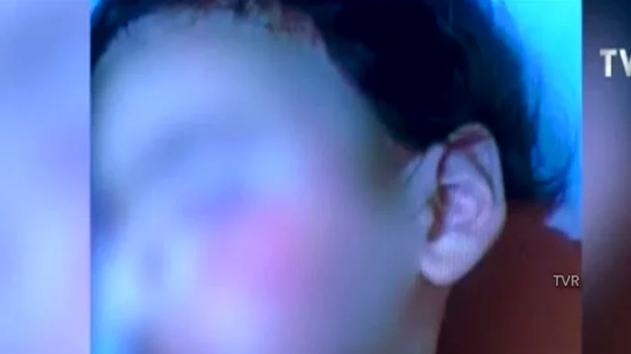 Un copil a fost desfigurat de un câine maidanez pe stradă Foto: stiri.tvr.ro