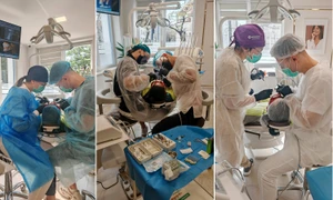 tot mai mul i adul i pierd din ii prematur in romania ce solu ii prin implanturi dentare sunt disponibile1 jpg