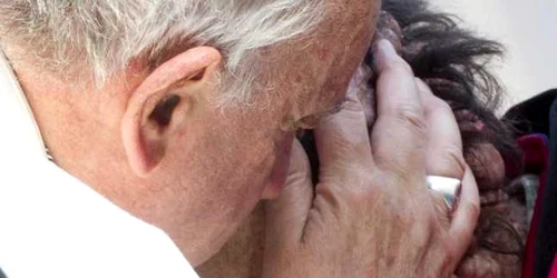Papa Francisc îmbrăţişând un om desfigurat