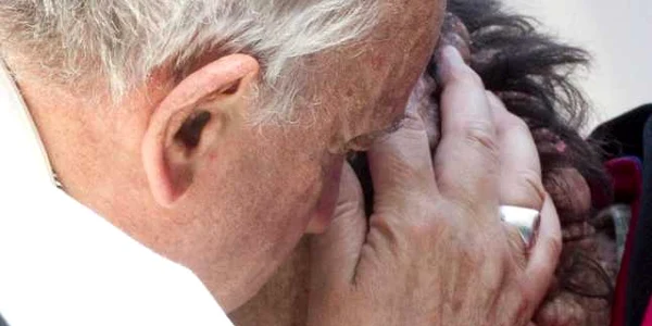 Papa Francisc îmbrăţişând un om desfigurat